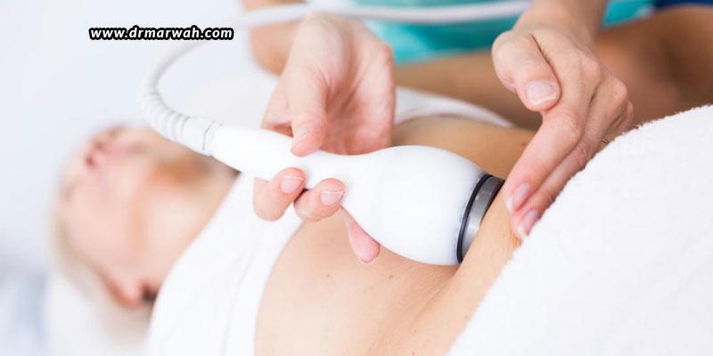 Body Shaping – CoolSculpting Or UltraShape?