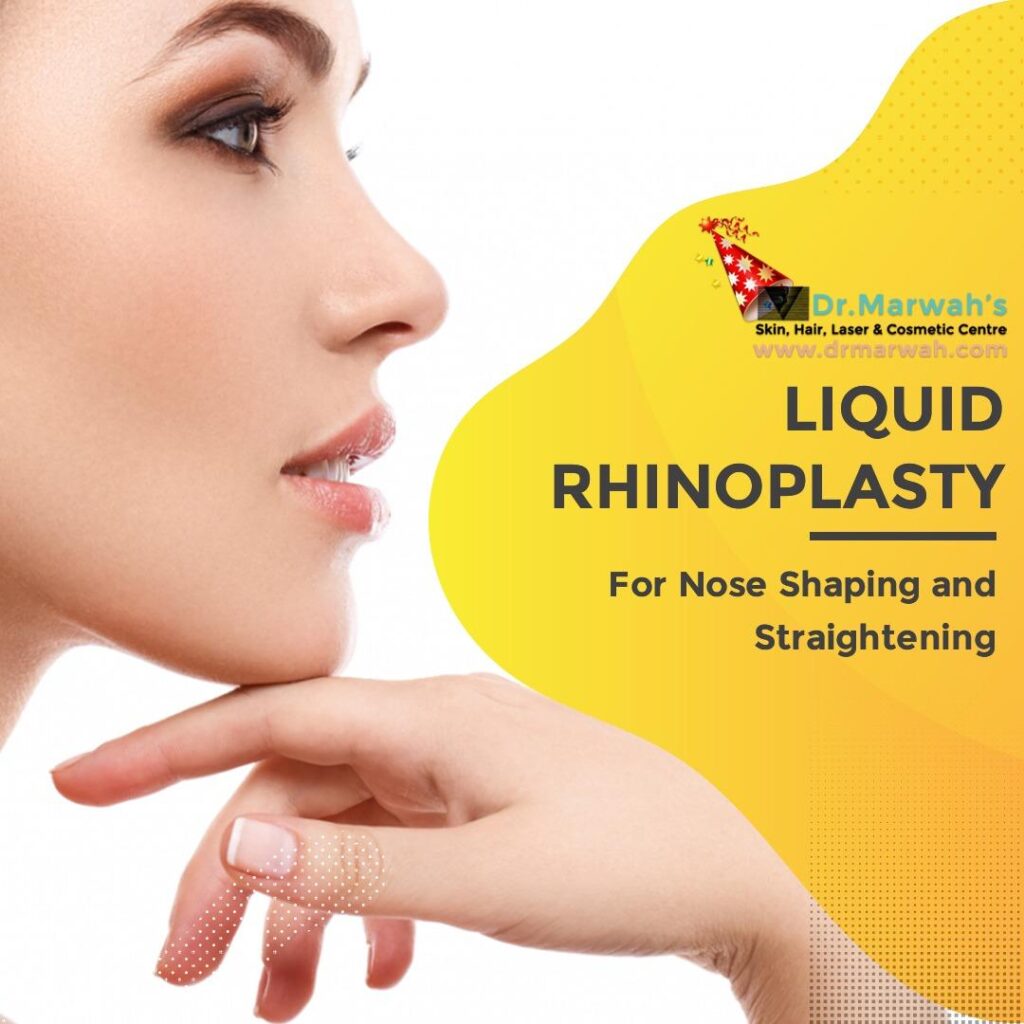 Liquid rhinoplasty- Everything you need to know about Non-surgical nose fillers