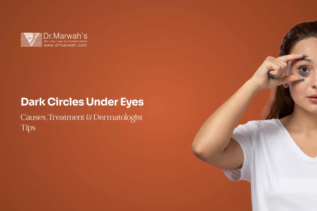 Dark Circles Under Eyes: Causes, Treatment & Dermatologist Tips