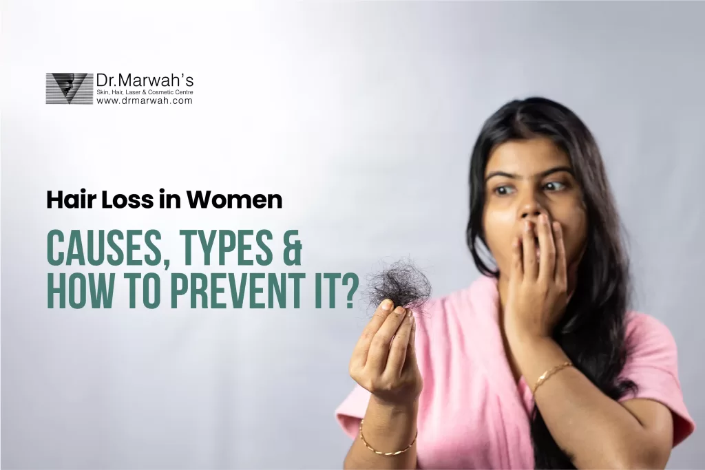 Hair Loss in Women: Causes, Types & How to Prevent It