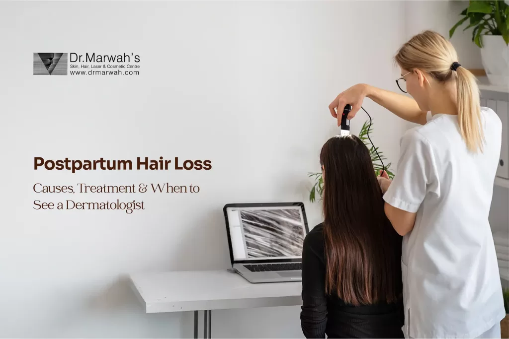 Postpartum Hair Loss: Causes, Treatment & When to See a Dermatologist?