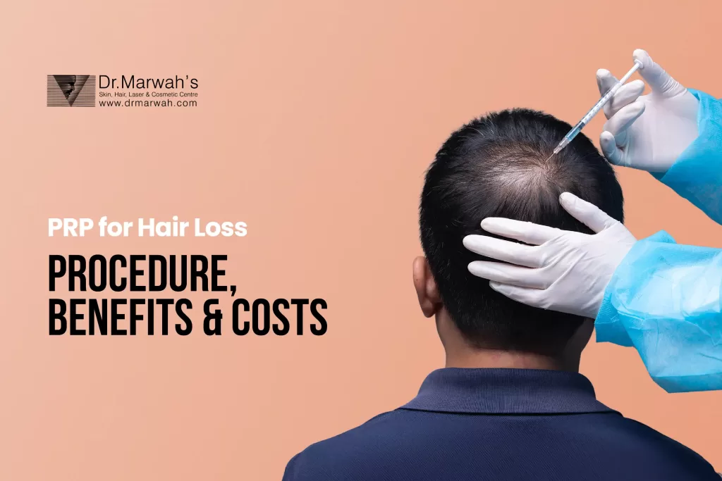 PRP Hair Treatment: Procedure, Benefits & Costs