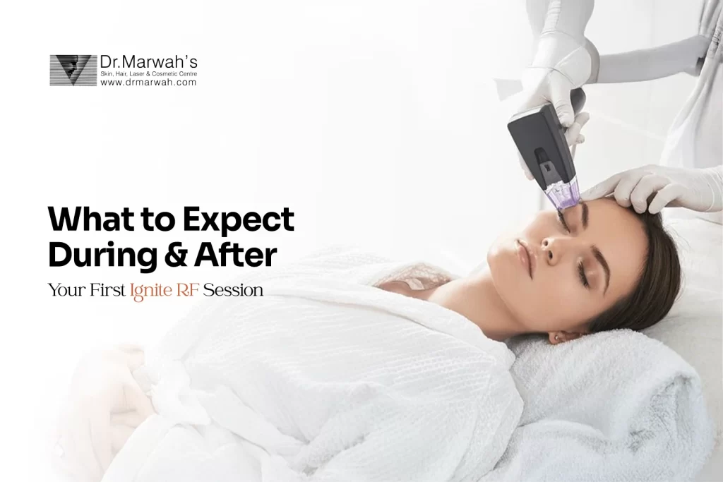 What to Expect During and After Your First Ignite RF Session?