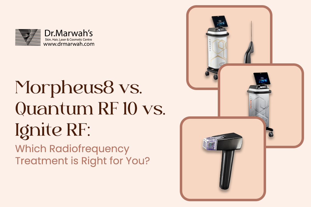 Morpheus8 vs Quantum RF 10 vs Ignite RF: Which Radiofrequency Treatment Is Right for You?