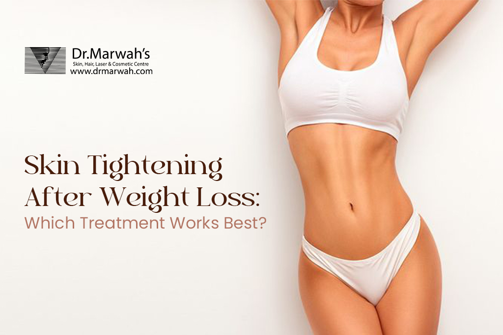 Skin Tightening After Weight Loss: Which Treatment Works Best?