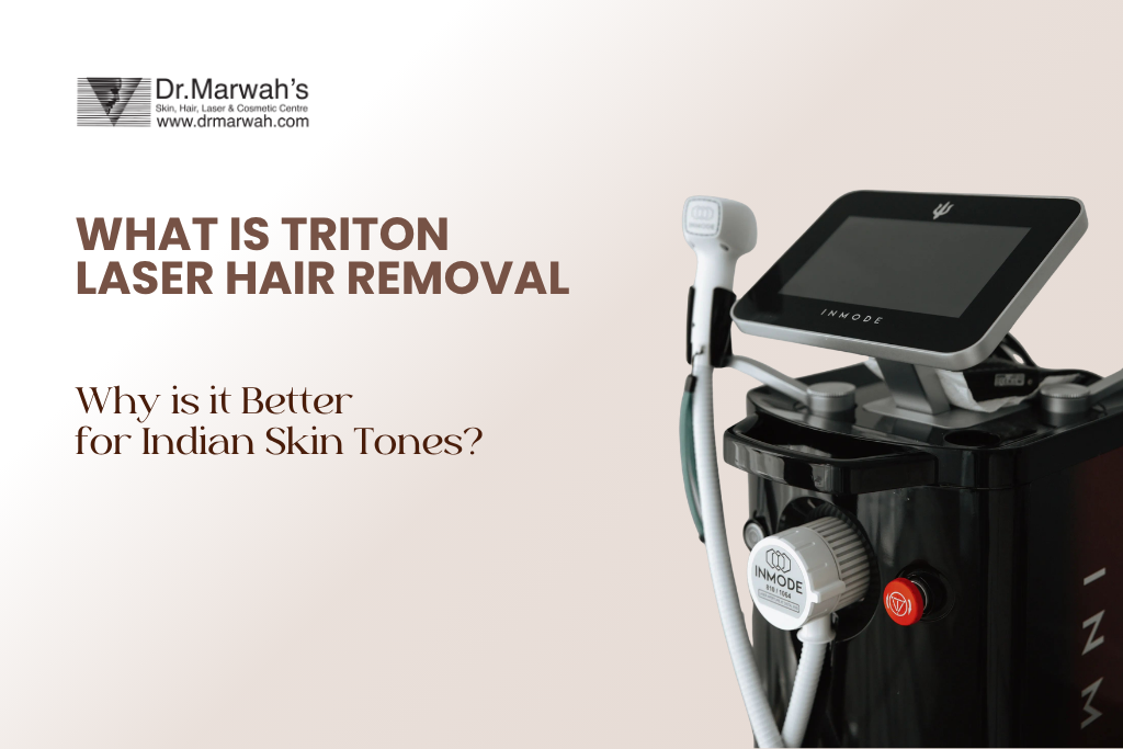 What is TRITON Laser Hair Removal and Why is it Better for Indian Skin Tones?