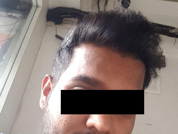 Hair Transplant After Treatment