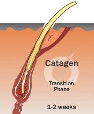 Hair Transplant Treatment