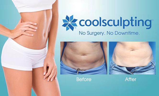 Myths And Facts About CoolSculpting Body Shaping Treatment – Dr