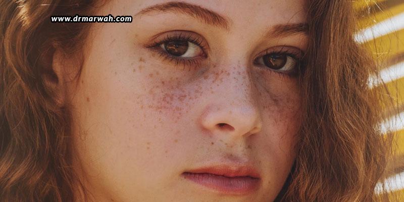Are-there-any-home-remedies-to-control-pigmentation