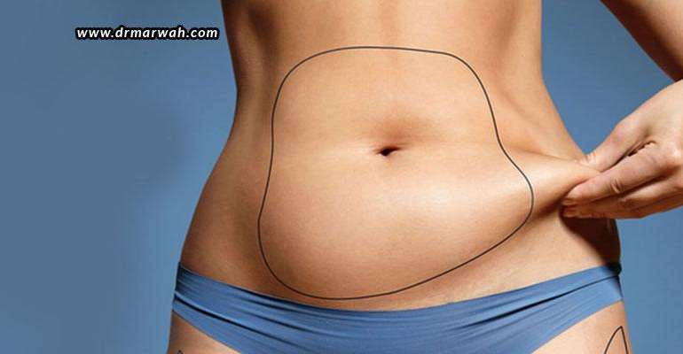 CoolSculpting – How Does It Work?