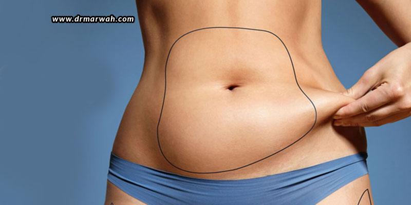 CoolSculpting – How Does It Work?