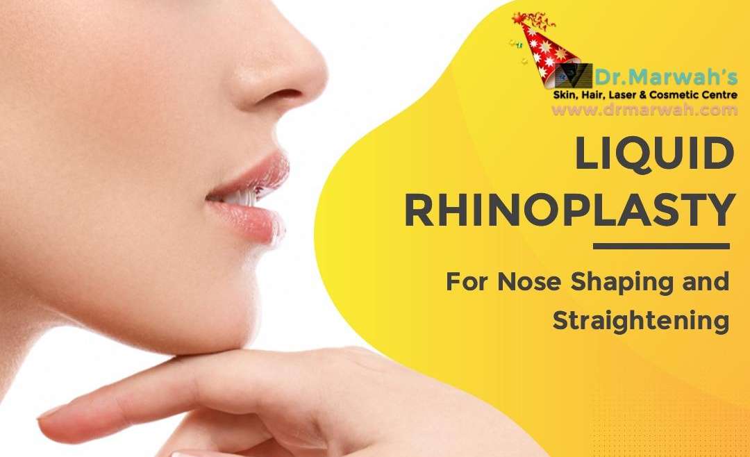 Liquid rhinoplasty- Everything you need to know about Non-surgical nose fillers