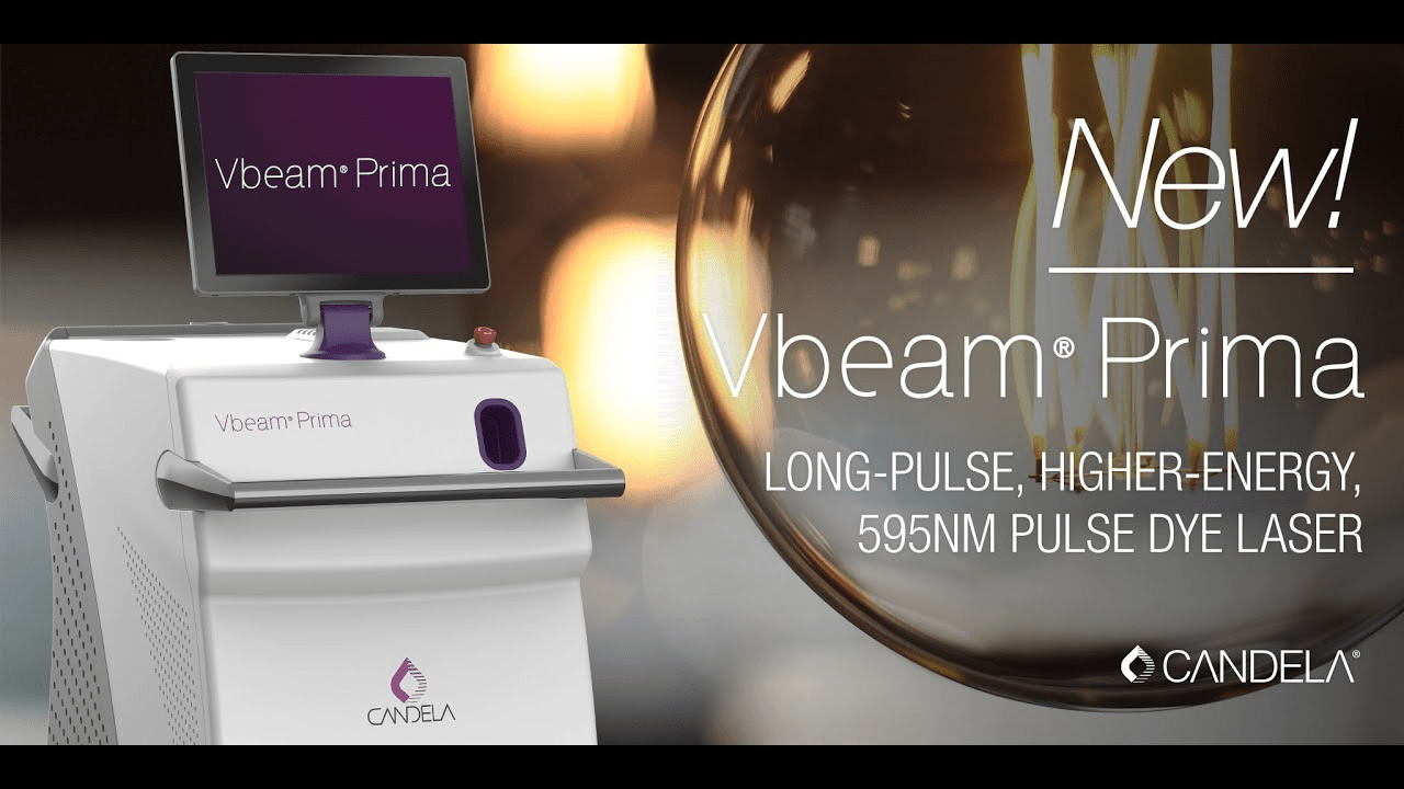 Vbeam Prima- The New Age Technology