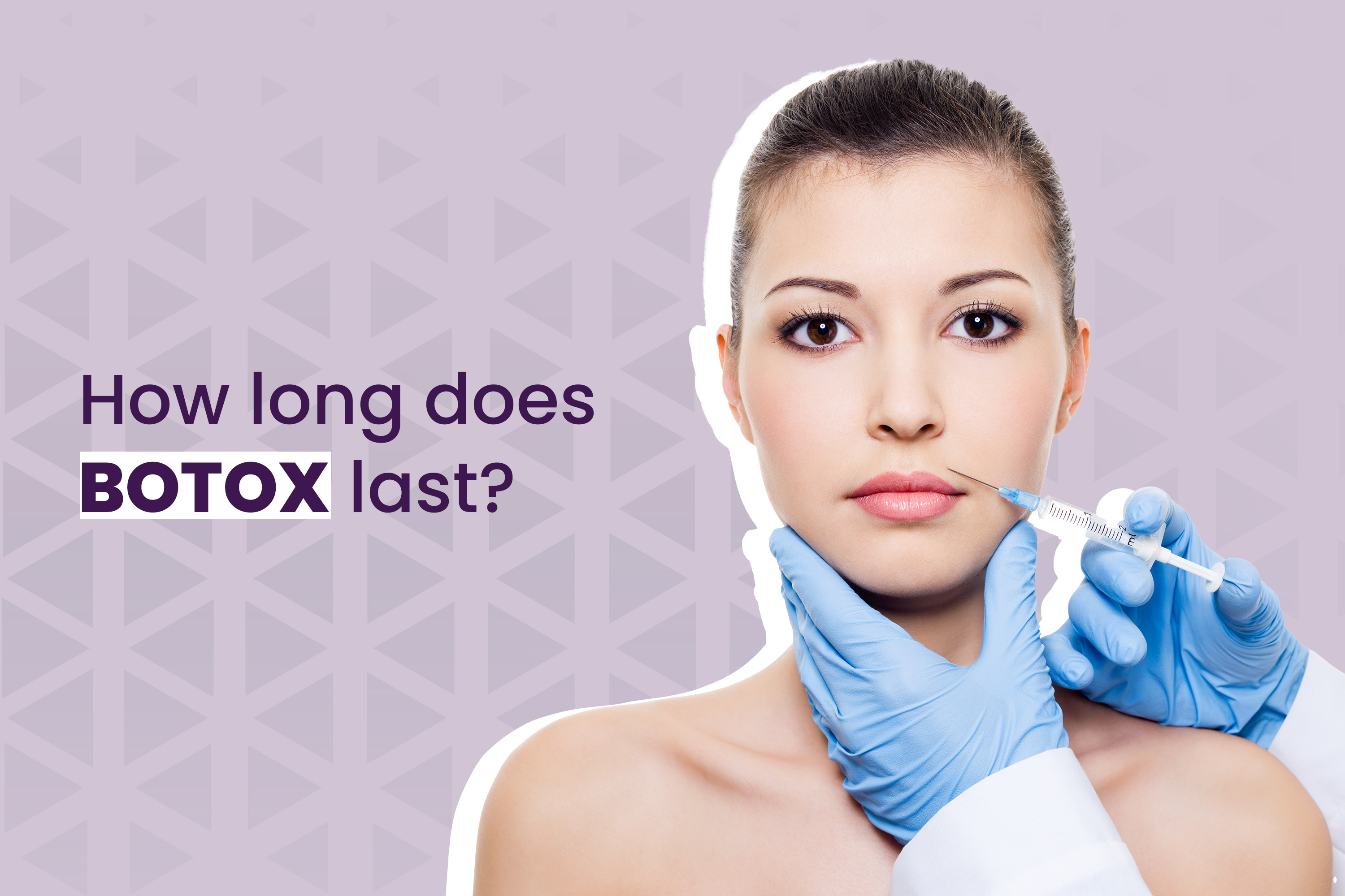 How Long Does Botox Last?