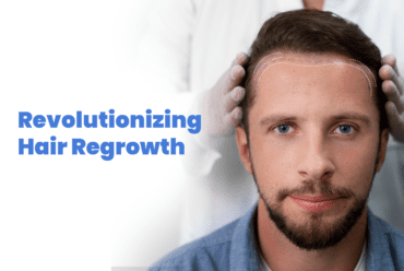 Revolutionizing Hair Regrowth: How Dr. Marwah’s Clinic Combines FUE, PRP, and QR 678 for Optimal Results