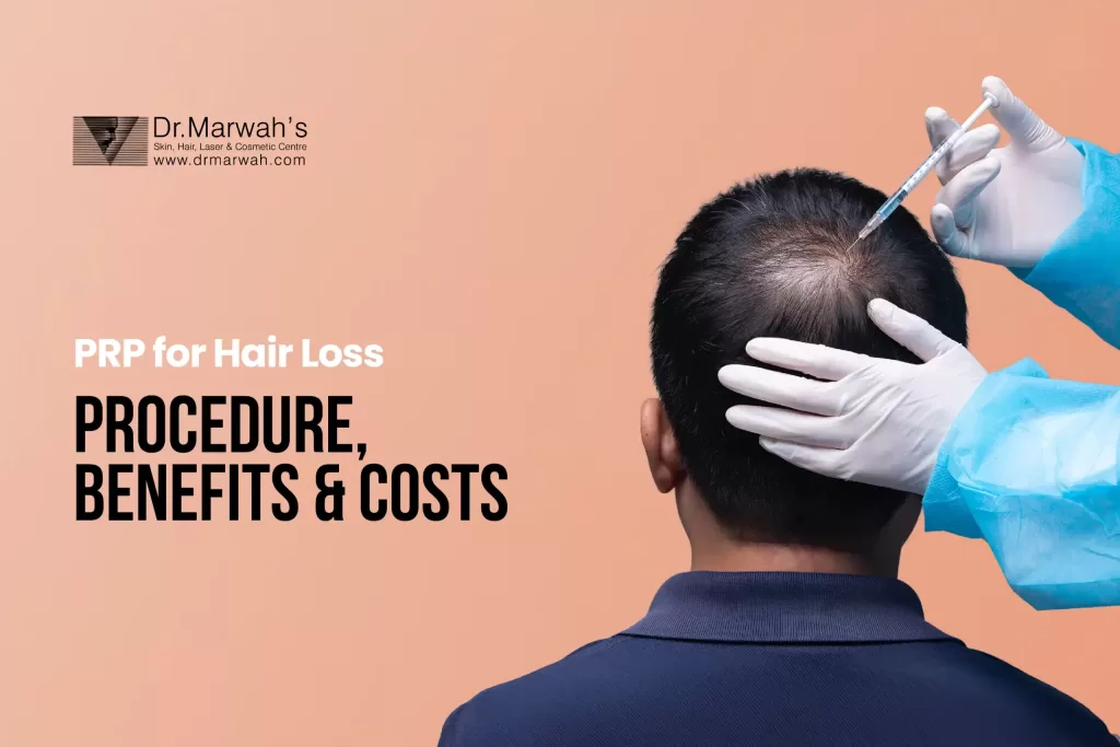 prp for hair loss
