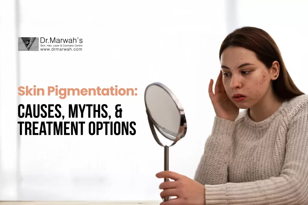 skin pigmentation cause,treatment and myth