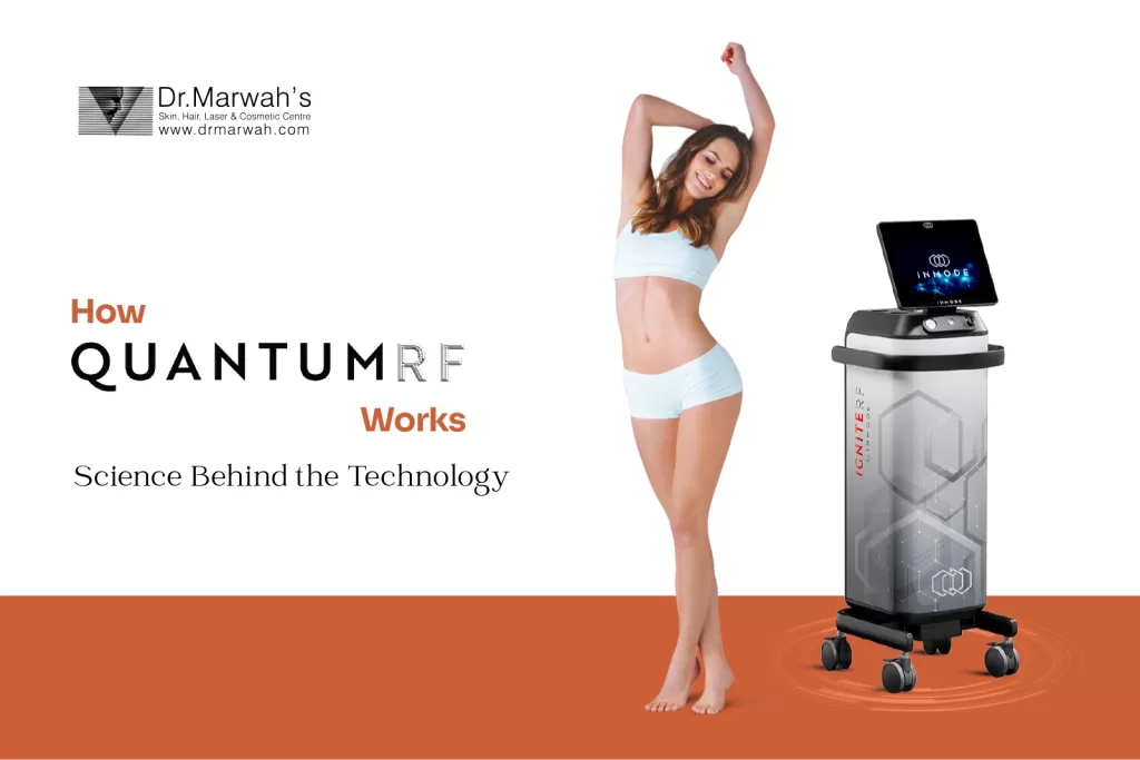 how Quantum RF technology works